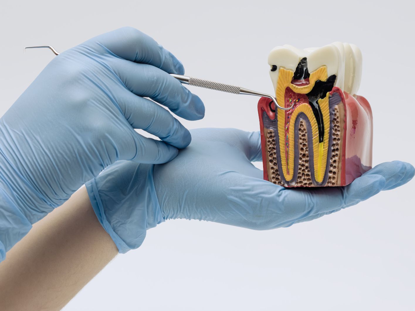 endodonzia