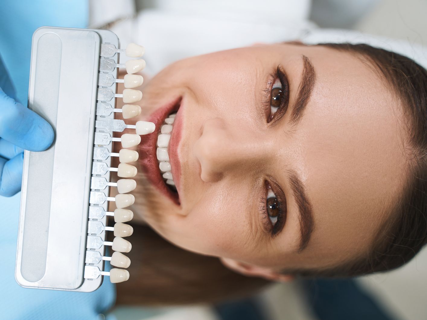 estetica dentale